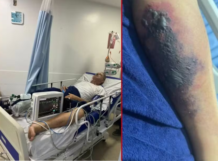 Homem de 65 anos morre em Morro de São Paulo; suspeita de picada de inseto Homem de 65 anos morre em Morro de São Paulo; suspeita de picada de inseto